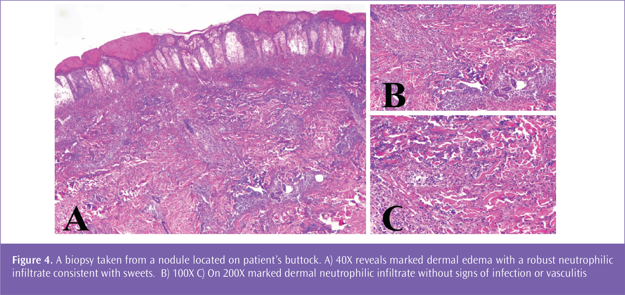 jtad-16-69-g4.png